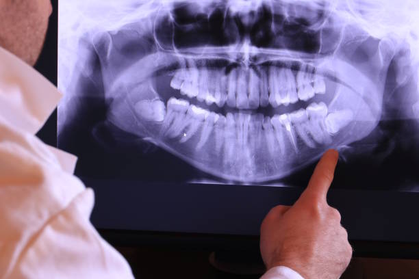 Best Broken or Cracked Tooth Emergency Dentist in Paw Paw, MI